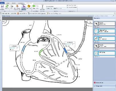 cardiology only scheduling system, Centricity Cardio Workflow offers multiple advanced interfaces