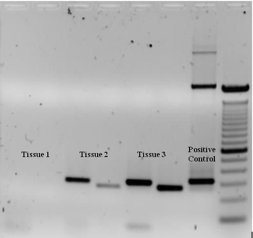 Figure 7. This an agarose gel of 3 Assue samples ran in PCR with two primer sets.