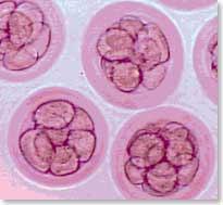 Questions to consider Why the accumulation of frozen embryos from IVF?