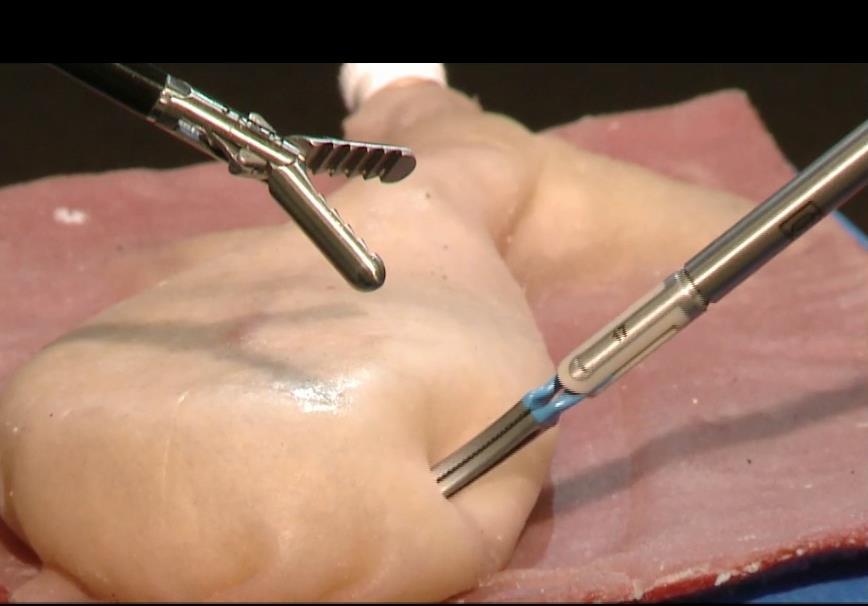retaining sensing of touch: Provides the surgeon with critical safety awareness of