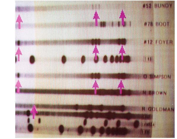 Electrophoresis use in forensics Evidence from murder trial Do you think suspect is guilty?