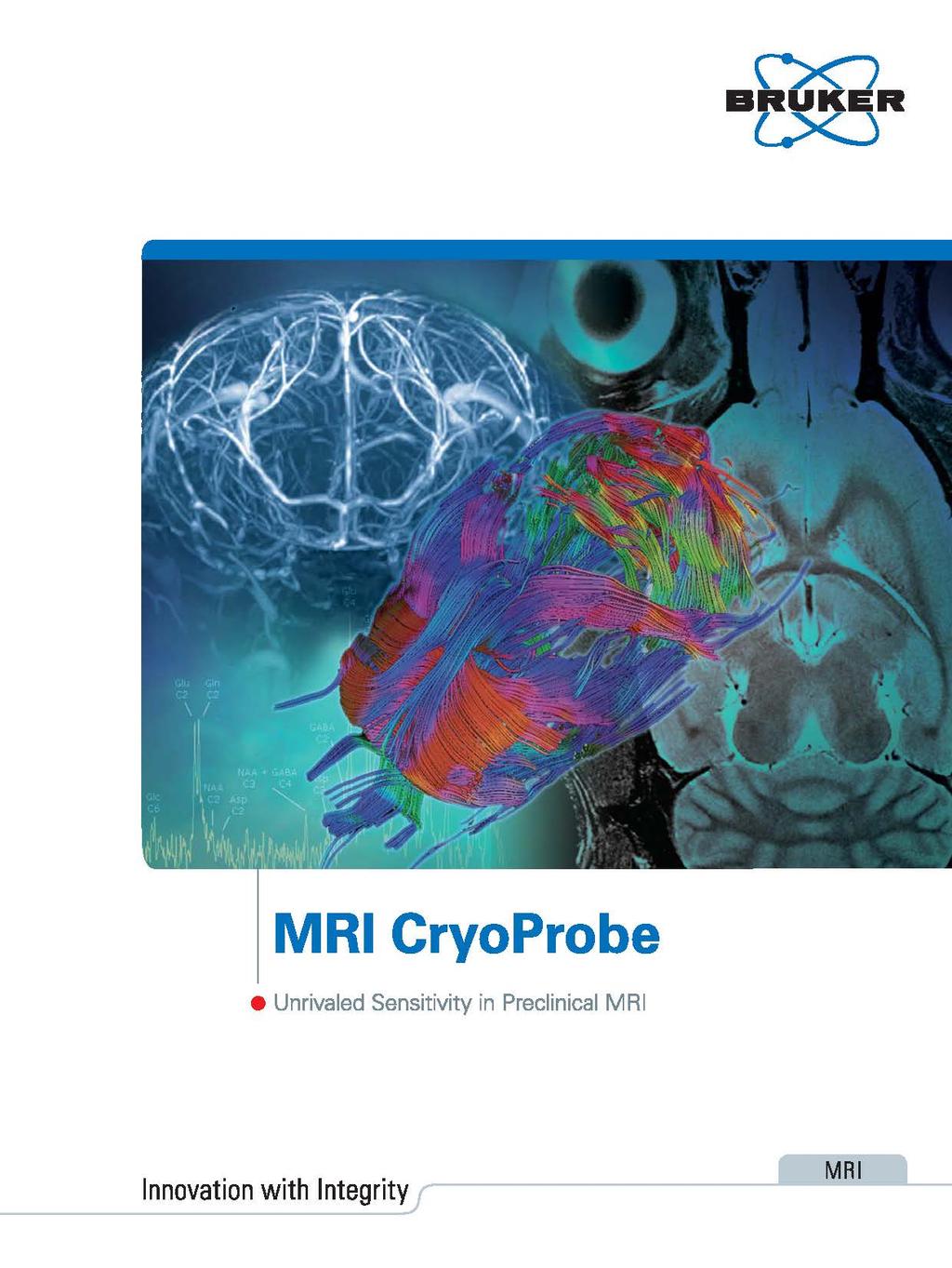 MRI CryoProbe Unrivaled Sensitivity in
