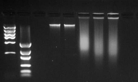 Genomic DNA Fragmentation DNA Marker DNA Marker Liquid Blood (Column) DBS (Column) DBS (Lysis Prep) DBS (Boil Prep) DBS (Methanol Boil) 10 kb 6 kb 4 kb 3 kb 2 kb 1 kb