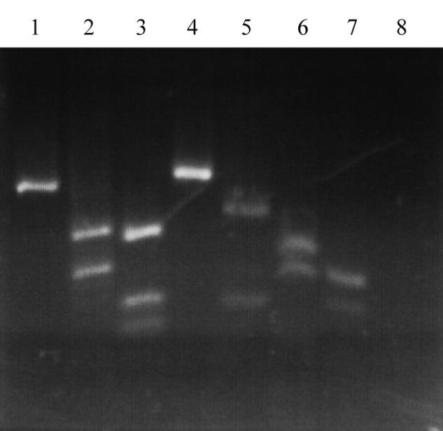 32 Slika 11: Slika agarozne elektroforeze restrikcijskih fragmentov pomnožkov qrt-pcr gena sox2.