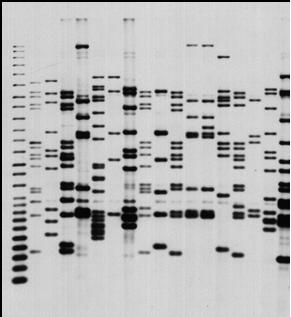 Genotyping Methods PCR-based Spoligotyping (15 digits) Spacer oligonucleotide typing MIRU (12 x 2 loci) Mycobacterial intersperced repetitive