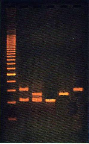 Analysis of a Single DNA Polymorphism PCR results of