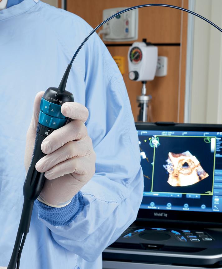 Interventional Cardiology Positive interventional outcomes begin with detailed imaging.