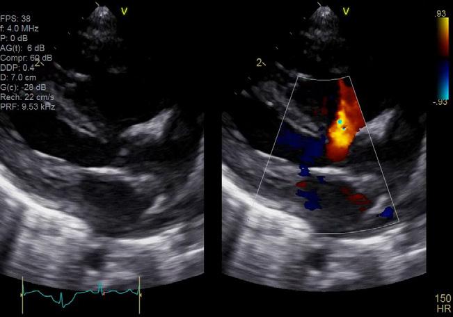 Pediatrics Small structures and fast heartbeats present unique challenges to imaging.