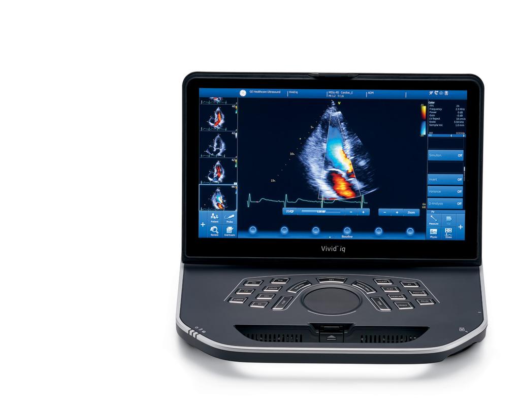 Reliability The Vivid iq 1 was built to handle tough daily demands allowing you to focus on the patient and the ultrasound images during the exam.