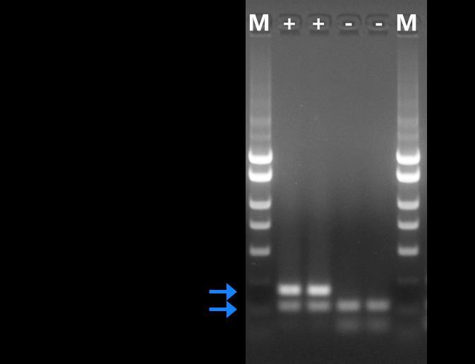 Figure 1: A representative 1X TAE, 1.4 % agarose gel showing the amplification of G. intestinalis at different concentrations.