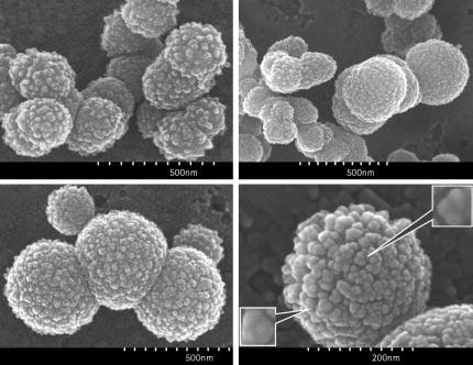 SARS-CoV SEM Figure 2. SARS-CoV observed under scanning electron microscope A B C D (A) Virions with diameter of 200 nm. (B) Virions with sizes of 100 and 200 nm. (C) Virions of 400 nm in diameter.