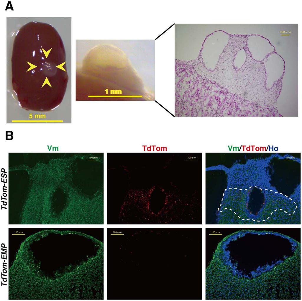 Figure 3. Macroscopic and microscopic findings of human endometrium-like tissues reconstituted in the in vivo stem cell assay.