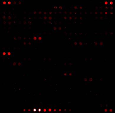 Human Array probed with 5 μg/ml Array Control Protein and Anti-V5-Alexa Fluor 647 Antibody Array image Boxed Area shown in detail Alexa Fluor Ab Alexa Fluor Ab Alexa Fluor Ab Calmodulin* V5 Control