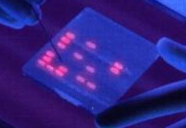 A permanent record of the gel is kept by taking a picture with a camera or gel documentation