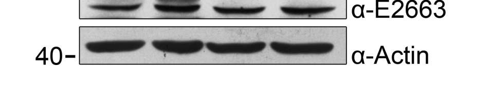 Then total proteins were extracted and equal amounts of each treatment were subjected to western blot analysis.