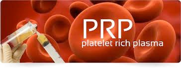 Working definition of PRP = 1,000,000 platelets/μl in 5ml plasma Concentrated plasma which contains 4-6 times the number of platelets normally found in the blood Marx RE.