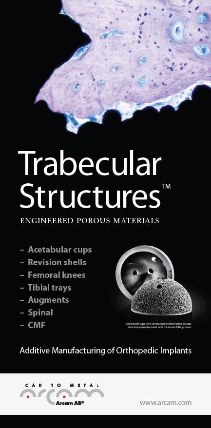 Freedom in Design Design for function Integrated trabecular structures for improved osseointegration Enables mass customization Excellent Material Properties Controlled