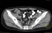 Figure 1. PET/CT multimodality images.