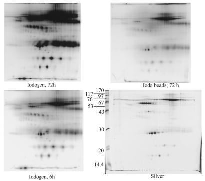 Figure 3. Comparison of sensibility of radioactive labeling ( 125 I) and silver staining in the detection of proteins separated by 2D gel electrophoresis. [Figure reproduced with permission of Dr. M.
