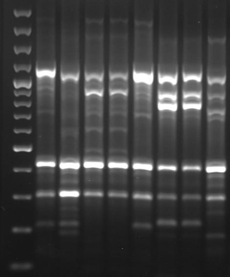 39 4 REZULTATI 4.1 ERIC-PCR Z metodo ERIC-PCR smo preverili vse izolate bakterij E. coli in P. aeruginosa izoliranih iz pomivalnih strojev. Med 8-imi izolati E.