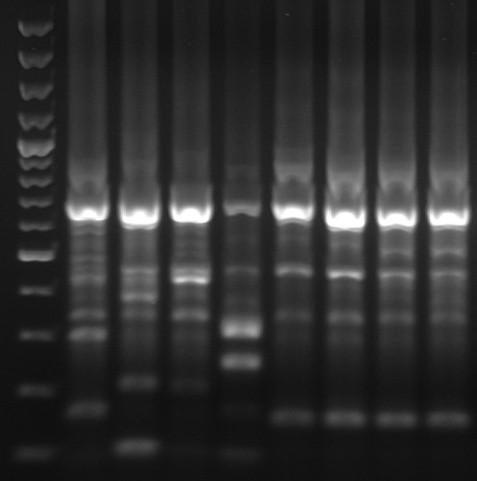 coli so predstavljeni na Sliki 3, kjer je razvidno, da sta bila profila ERIC-PCR izolata N3 in N4 ter N6 in N7 enaka, zato smo sklepali, da gre za isti sev. Rezultati izolatov P.