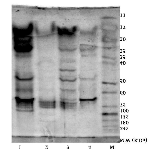 Molecular weight determination by SDS-PAGE: Fig 2 SDS-PAGE analysis of crude extracellular extract of actinomycete isolate Lane 1: Extract of BR-13, Lane 2: Biomass of BR-13, Lane 3: Crude