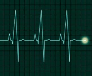 electrocardiogram (ECG) through leads and sensors attached to the patient; it also typically displays heart rate.