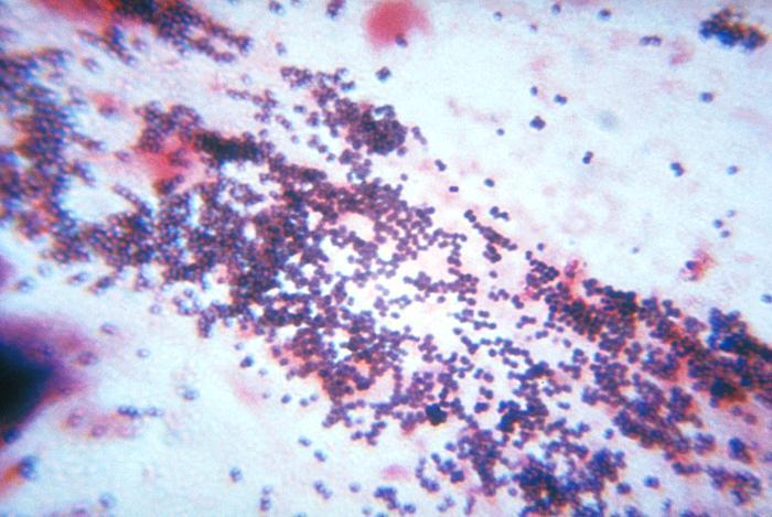 8 Gram Staining Gram Staining What is Gram Staining? The method of Gram Staining was developed in 1884 by a Danish scientist Hans Christian Gram.