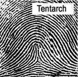 Fingerprint Analysis Fingerprints are more unique than DNA: each one is distinctive and different.