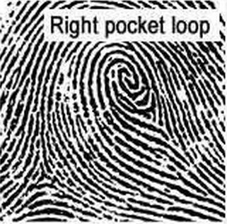Fingerprint patterns are set for life and do not change when a person ages, although the prints can acquire scars or get worn down.