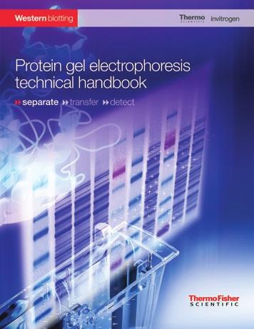 Get useful information for improving your protein separation and western blot results from our protein