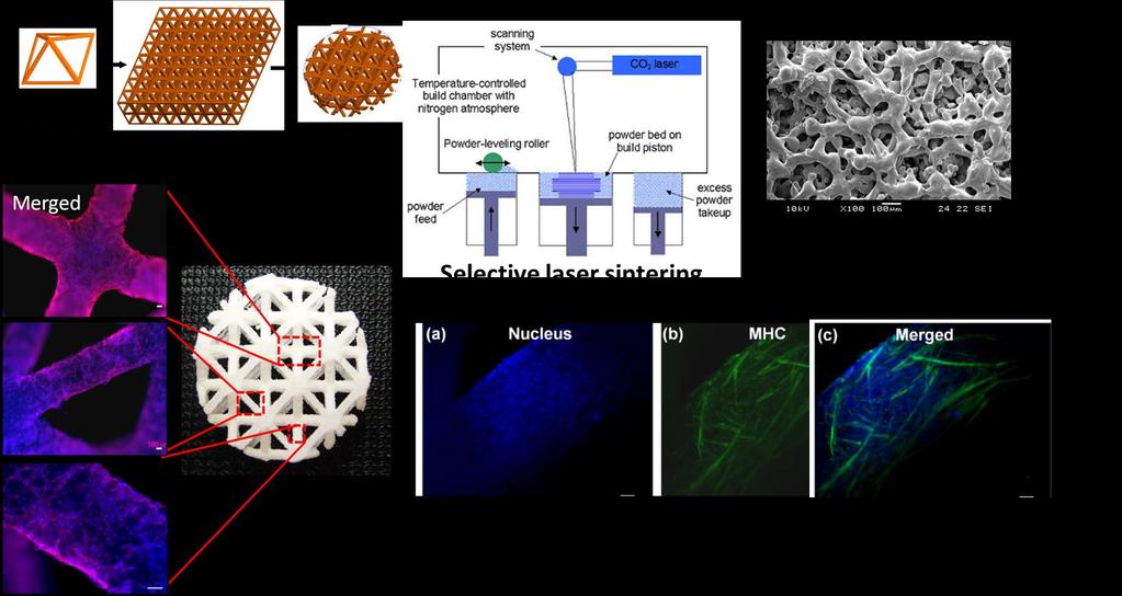 New combination medical device: 3D Printed Biodegradable