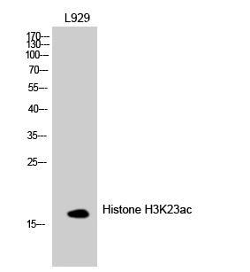 Histone H3K23ac (Acetyl H3K23) Polyclonal Antibody (Component Cat. #-1-3K23A) Histone H3 along with H2A, H2B and H4 is involved in the structure of chromatin in eukaryotic cells.