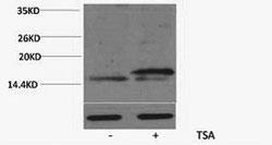 Histone H3K36ac (Acetyl H3K36) Polyclonal Antibody (Component Cat. #-1-3K36A) Core component of nucleosome.