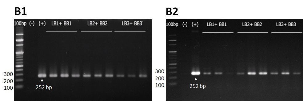 5 µl of total 50 µl purified DNA from 10 mg FFPE tissues was used for each real time PCR reaction with a total volume of 25 µl.