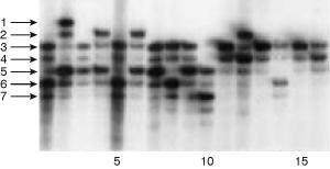 IV. Common Applications of PCR: Example of typing for a CA repeat Genotypes 1(3,6) 2(1,5) 3(3,5) 4(2,5) 5(3,6) 6(2,5) 7(3,5) 8(3,6).