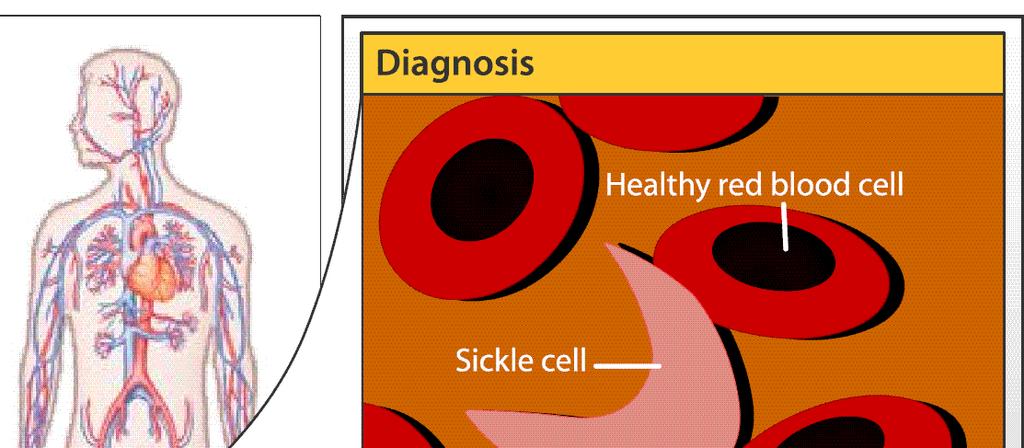 The recessive allele that causes sickle-shaped red blood cells helps protect the cells of heterozygous individuals from the effects of.