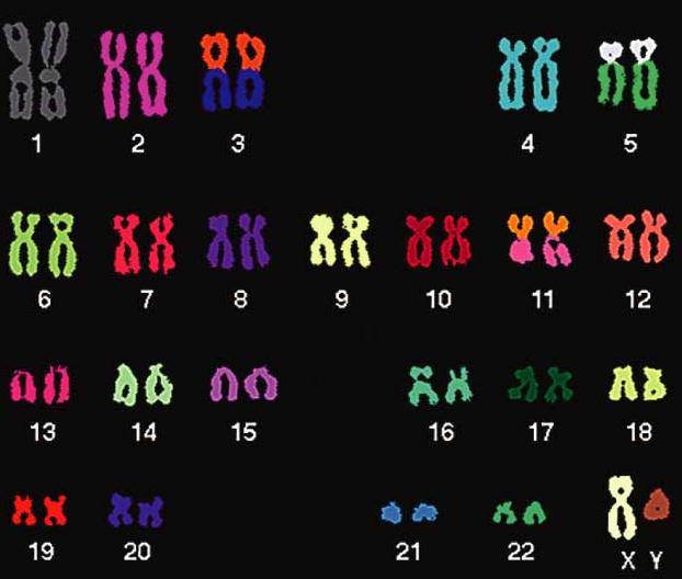 A Karyotype is an Arranged Picture of Chromosomes At Their Most Condensed
