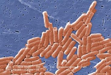 identify a hospital outbreak of Salmonella and used for