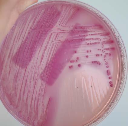 Figures Figure 1. Typical appearance of E. coli on MacConkey agar supplemented with 1 mg/l cefotaxime.
