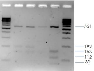 Classifying PCR Experiments Type I: to target amplification of a known region of nucleic acid Sequence is