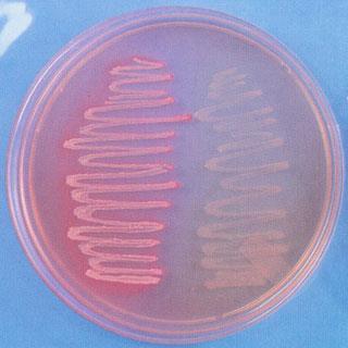 E. coli and Proteus on