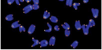 Telomeres 1. Each round of replication shortens the 5' end of the lagging strand (by about 100-200 bp) 2.