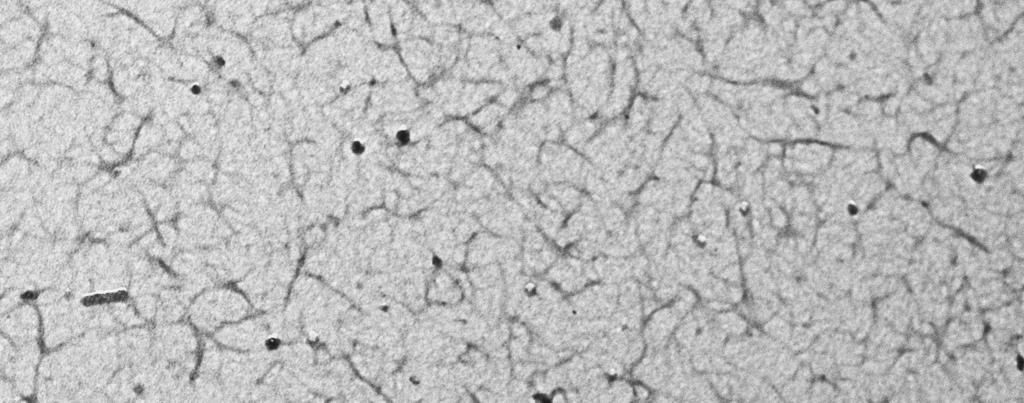 Three-dimensional surface fibrin networks TEM of dried