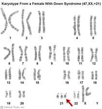 2. Changes in chromosome number often result in human disorders with developmental limitations, including Trisomy 21 (Down syndrome) and XO