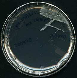 2. Growth on Solid Agar: The 13 strains of Escherichia coli were streaked on LB agar plates and growth was seen for all 13 strains on LB.