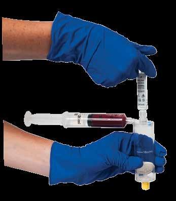 citrated blood sample attached to the Clotalyst