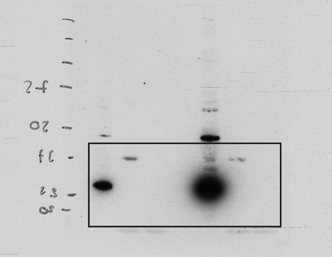 Supplementary Figure 15: Uncropped Western blot corresponding to