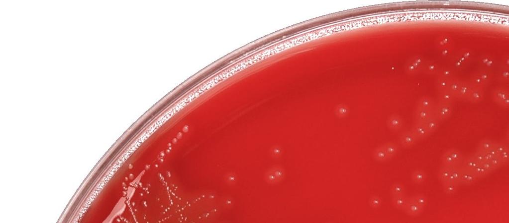 Plates and Tubes Blood Agar Plate, 5% Sheep Blood in Tryptic Soy Agar General growth medium. (This product is for laboratory use only; not for human diagnostic use.) 15x100mm plate, 19ml fill, 10/pk.