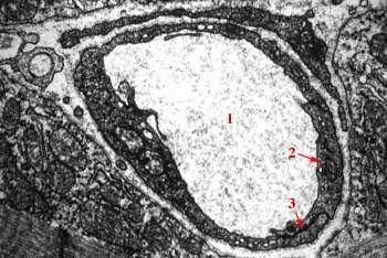 EM 10a: Endothelial cells